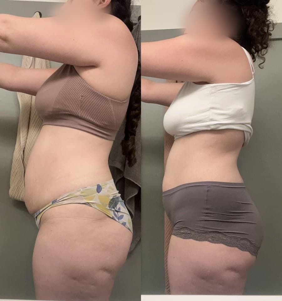 1:1 client before and after